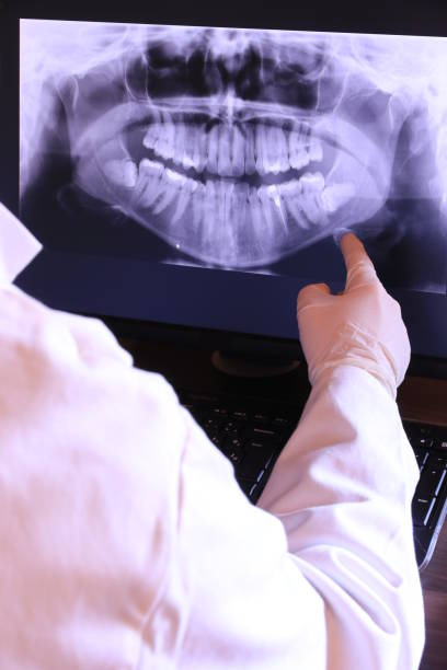 Best Emergency Dentist for Knocked-Out Tooth in Watervliet, MI