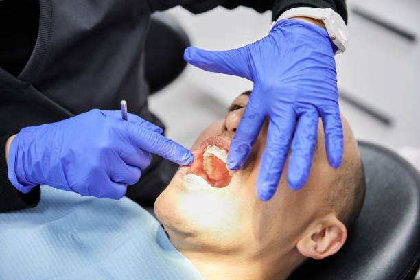 Best Emergency Root Canal Treatment in Watervliet, MI